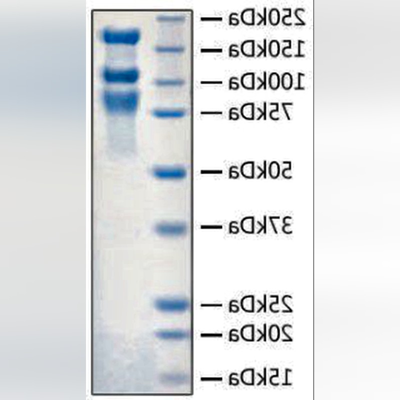 Recombinant SARS-CoV-2 S1S2 ECD-His Protein (HEK293)