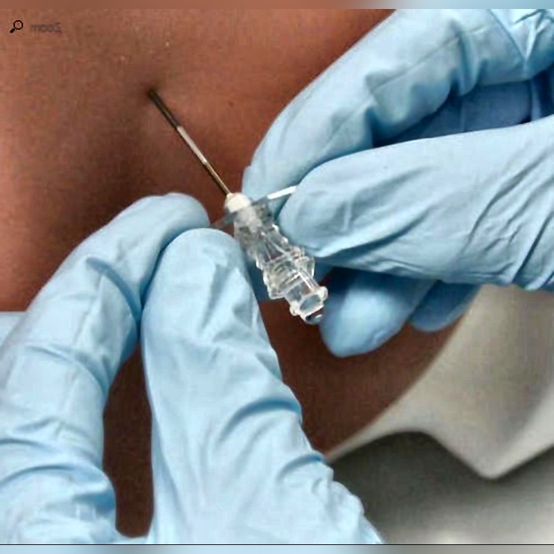 Epidural Anesthesia Simulator X-500 with Haptic Feedback Realistic Spinal Training