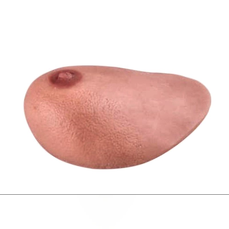 SONOtrain Breast Ultrasound Simulator with 3 Tumors