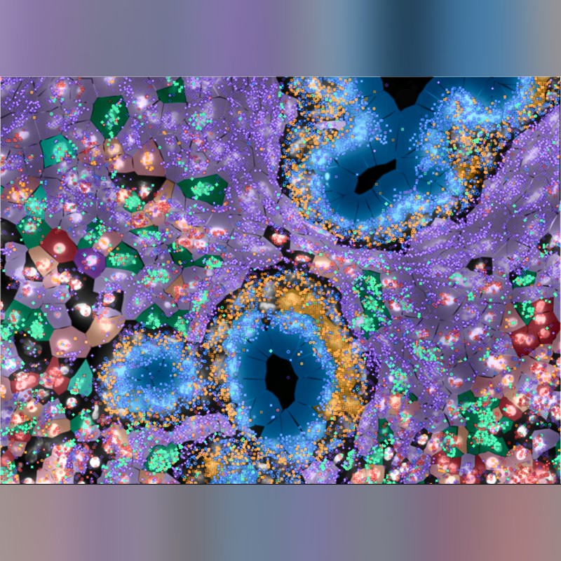 Xenium Analyzer High-Resolution Single Cell Spatial Imaging System