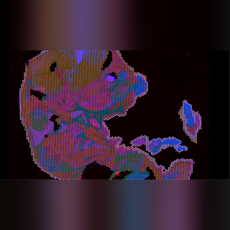 Xenium Analyzer High-Resolution Single Cell Spatial Imaging System