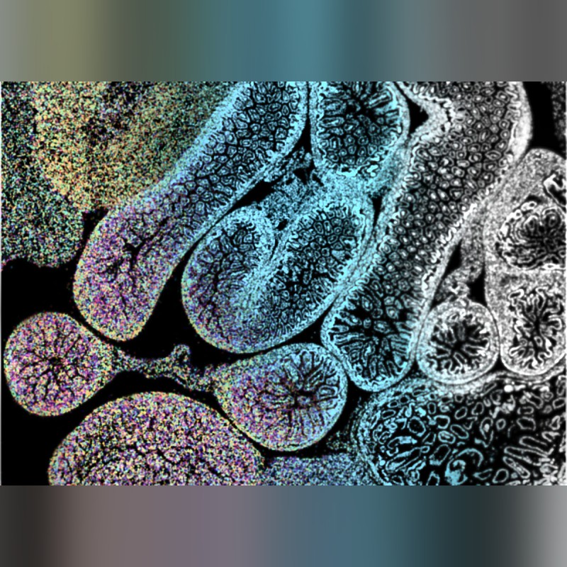 Xenium Analyzer High-Resolution Single Cell Spatial Imaging System